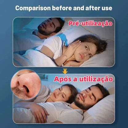 Kit 4 Clipe Nasal Anti Ronco e Apneia Dilatador Magnético